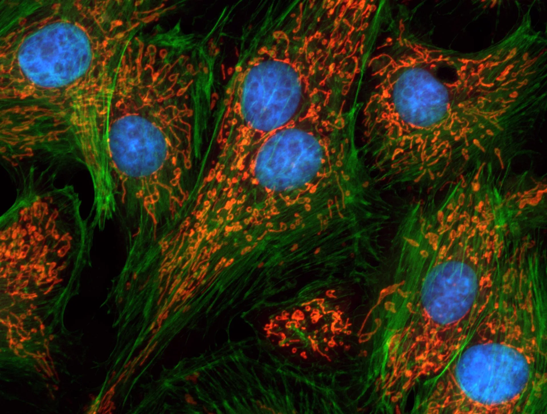 Triple-stain immunofluorescence micrograph of endothelial cells: blue nuclei, green actin filaments, red mitochondria